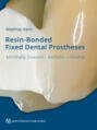 Resin-Bonded Fixed Dental Prostheses