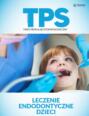 Leczenie endodontyczne dzieci